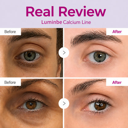 🔥LAST DAY 50% OFF!!Luminbe Korean Calcium Dark Spot Eye Cream